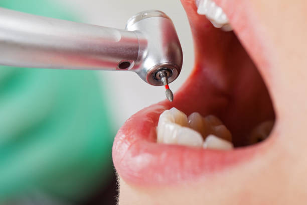 Best Emergency Dentist for Knocked-Out Tooth in Leola, PA